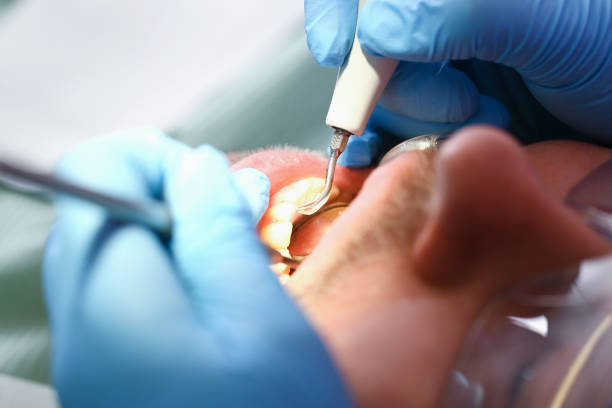 Best Emergency Denture Repair in Bon Air, VA